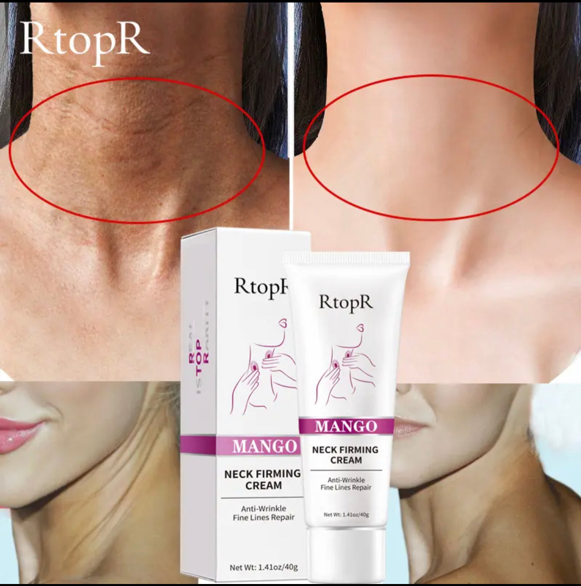 Neck Firming Wrinkle Remover Cream