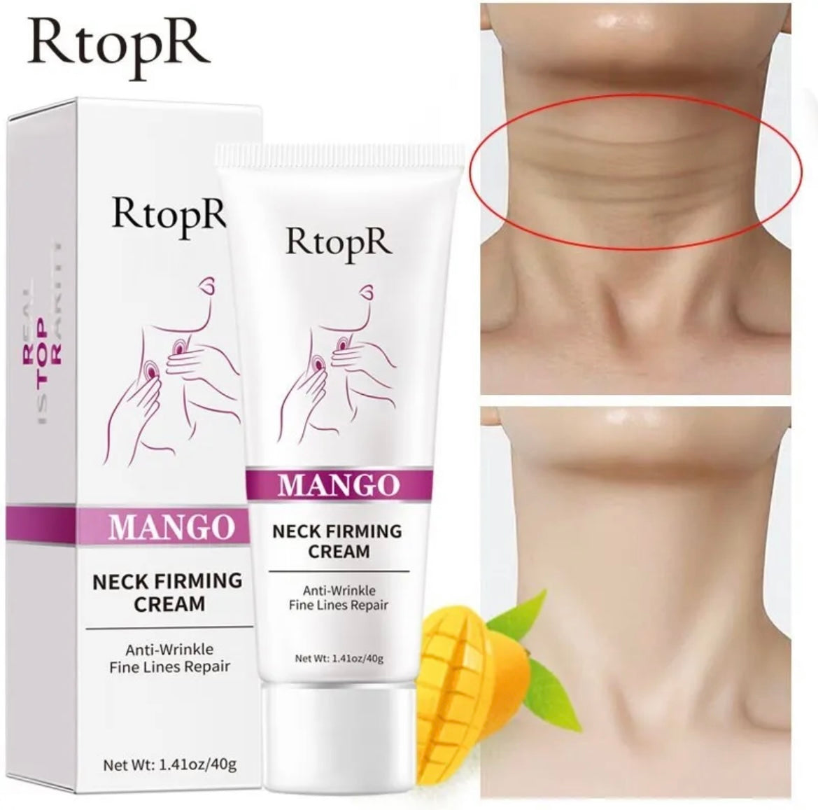 Neck Firming Wrinkle Remover Cream